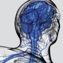 neuro-spinal-instruments-image-small