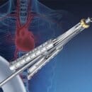 valvegate-pro-image-small