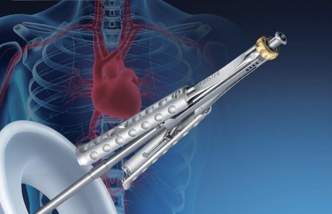 valvegate-pro-product-image-header-1